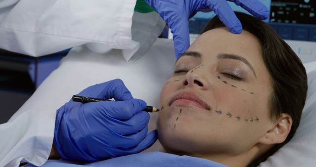 Plastic Surgeon Marking Woman’s Face for Cosmetic Surgery - Download Free Stock Images Pikwizard.com