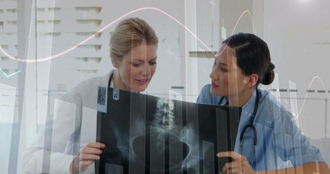 Medical Team Analyzing X-ray with Digital Data Overlay