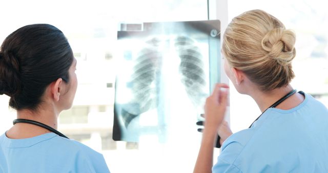 Healthcare Professionals Analyzing Chest X-ray in Hospital - Download Free Stock Images Pikwizard.com