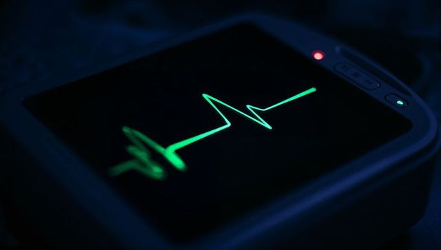 Hospital bedside ecg monitor displaying neon-green tracings