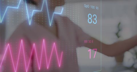 Colorful cardiographs with nurse assisting patient in hospital