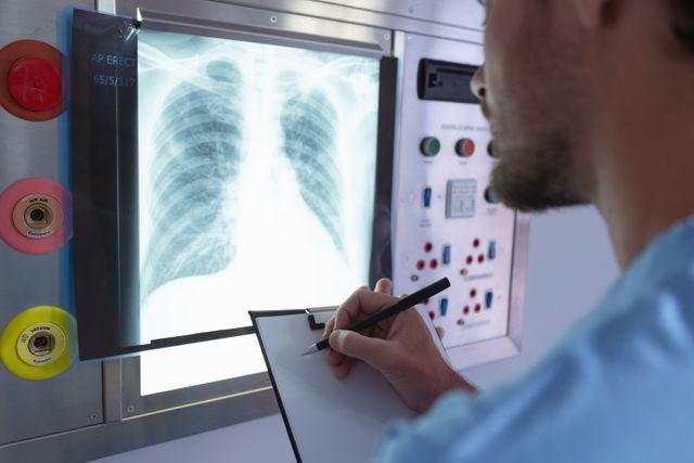 Surgeon Analyzing Chest X-Ray in Hospital Operation Room - Download Free Stock Photos Pikwizard.com
