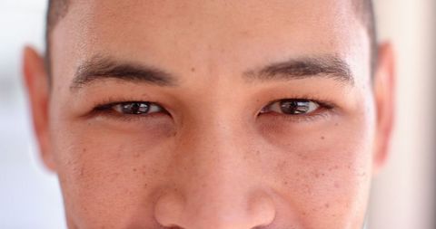 Close-up of freckled man's eyes showcasing natural beauty and confidence