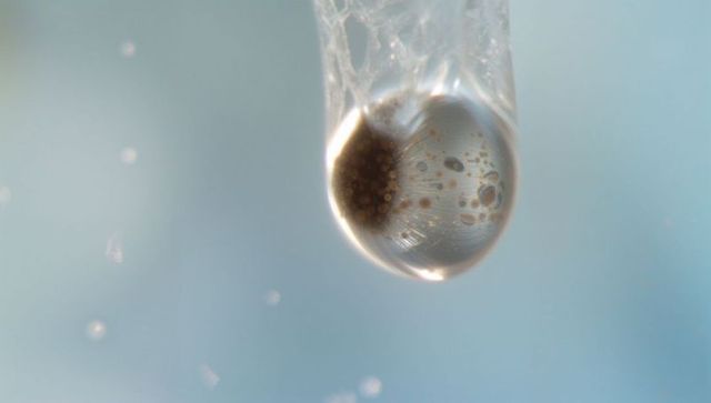 Microscopic droplet on filament revealing suspended particle cluster and caustic light