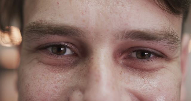 Close-Up of Young Man's Eyes with Natural Freckles and Smile Lines - Download Free Stock Images Pikwizard.com