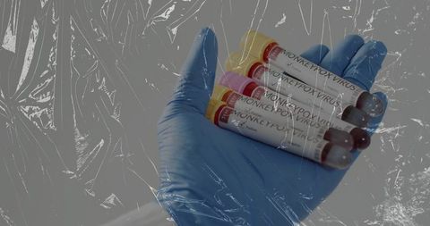 Blue-Gloved Hand Holding Monkeypox Virus Test Tubes in Laboratory Biosafety Closeup