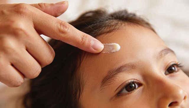 Applying cream to child forehead for soothing skincare and gentle caregiving