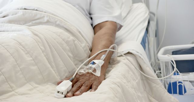 Hospitalized Patient with IV Drip and Monitoring Equipment - Download Free Stock Images Pikwizard.com