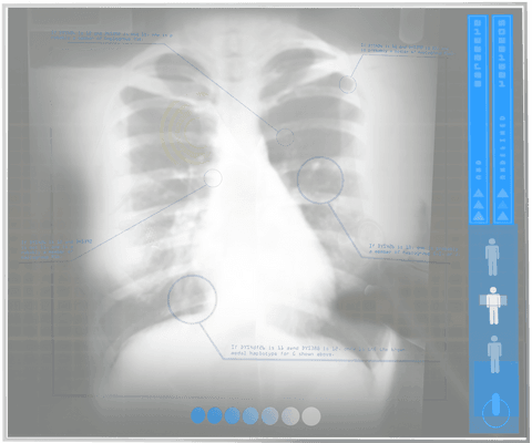 transparent digital chest x-ray with interactive elements - Download Free Stock Videos Pikwizard.com