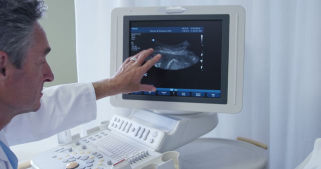 Doctor analyzing ultrasound results on screen in medical office - Download Free Stock Images Pikwizard.com