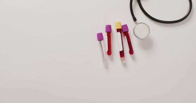 Image of close up of stethoscope with test tubes on pink background. global medicine and healthcare concept.