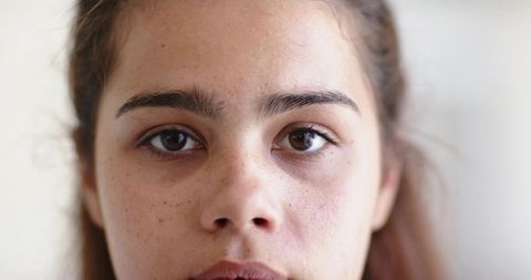 Closeup headshot of woman with freckles holding neutral expression and direct gaze