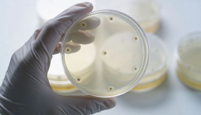 Gloved Hand Holding Petri Dish Showing Bacterial Colonies on Agar in Microbiology Lab