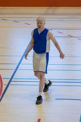 Athlete with albinism playing basketball in indoor court