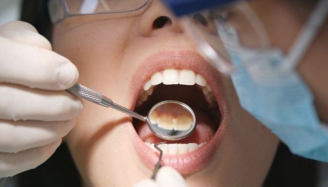 Closeup dental examination showing dentist examining open mouth with mirror and explorer