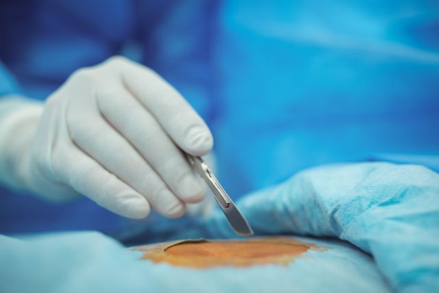 This image depicts a surgeon's hand holding a scalpel, making an incision on a patient's skin in a sterile operating room environment. Ideal for use in medical articles, healthcare websites, surgical procedure guides, and educational materials related to surgery and healthcare.