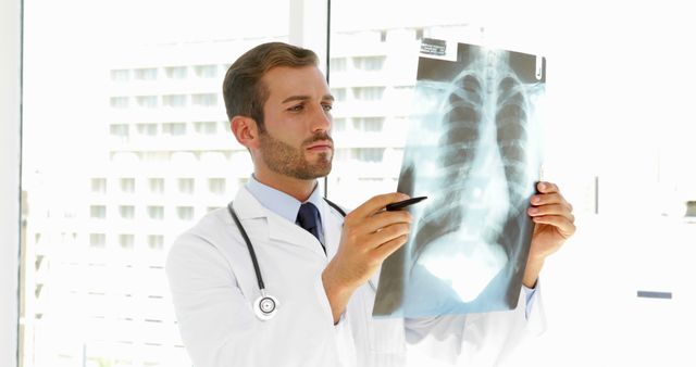 Male Doctor Examining Chest X-ray in Modern Hospital - Download Free Stock Images Pikwizard.com