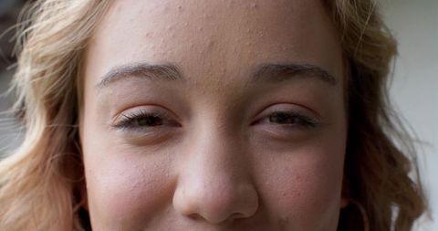 Close-up portrait young woman displaying natural skin texture, subtle smile, soft lighting