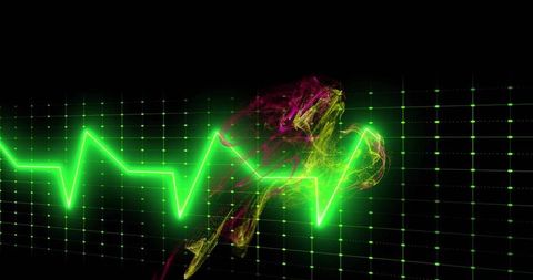 Neon ECG Waveform Pulsing Across Dark Grid with Glowing Green Beats and Magenta Trails