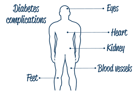transparent diabetes complications illustration with human silhouette - Download Free Stock Videos Pikwizard.com