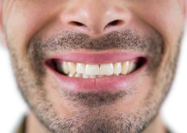 Close-up of a man smiling, showing his crooked teeth. This image can be used in dental care advertisements, oral health campaigns, or articles discussing dental imperfections and treatments. It can also be used in content promoting self-acceptance and natural beauty.