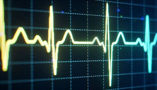 Neon ECG Heartbeat Waveform Pulsing Across Digital Monitor Grid for Cardiology Tech