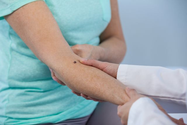 Dermatologist examining a mole on a patient's arm in a clinical setting. Useful for medical articles, healthcare websites, skin care awareness campaigns, and educational materials about skin health and dermatology.