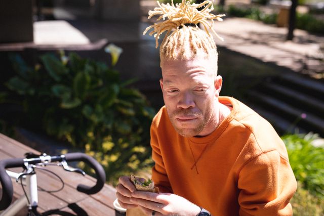 Young albino man sitting on a bench outdoors, enjoying a snack. Ideal for lifestyle, health, and urban living themes. Can be used in articles about albinism, inclusivity, and everyday activities.