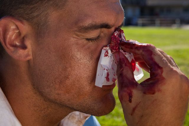 Close up of rugby player with injured nose at playing field
