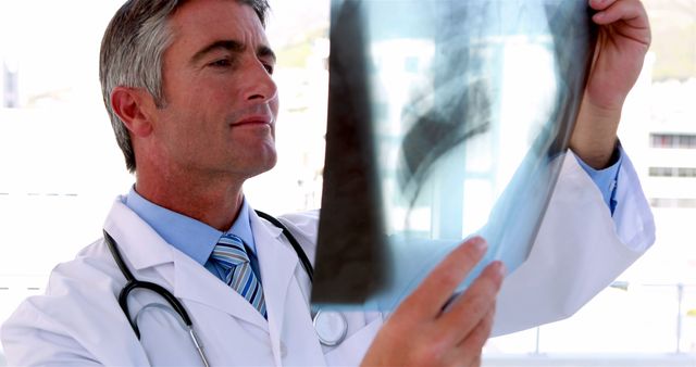 Doctor analyzing an x-ray film in a hospital setting. Ideal for use in medical, healthcare, and professional imagery, including websites, blogs, and informational brochures focusing on radiology, medical diagnostics, and doctor-patient interactions.