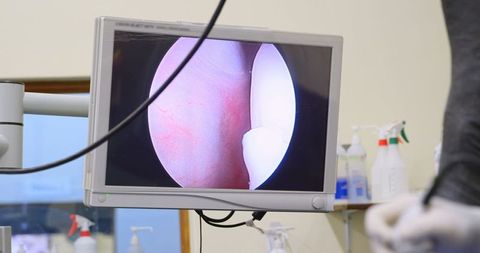 Veterinary surgeon utilizing endoscopic camera during horse surgery