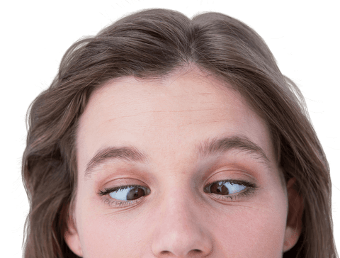 Caucasian Woman Crossing Eyes Transparent Background