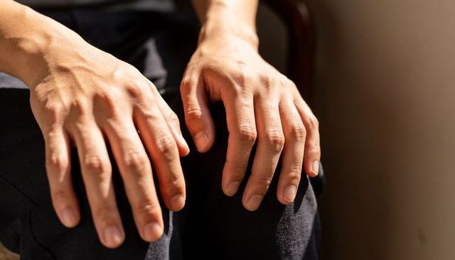 Close-up adult hands resting on knees in warm natural light showing skin texture and veins