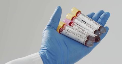 Gloved hand holding blood tubes labeled monkeypoxvirus for laboratory diagnostic testing