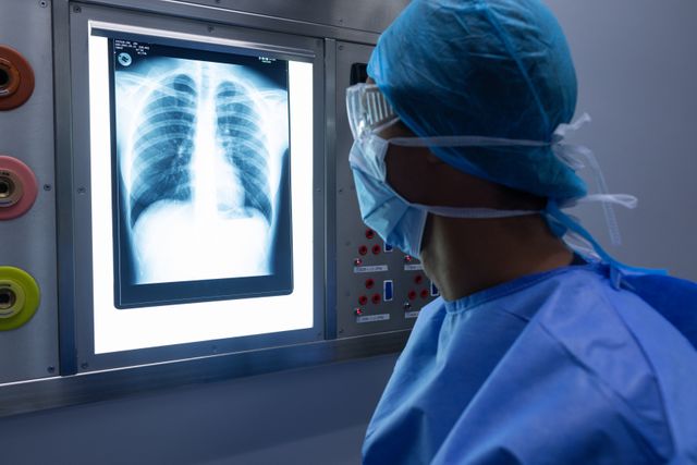 Surgeon in operating room examining chest x-ray on light box. Useful for medical, healthcare, and hospital-related content. Ideal for illustrating surgical procedures, diagnostic processes, and professional medical environments.