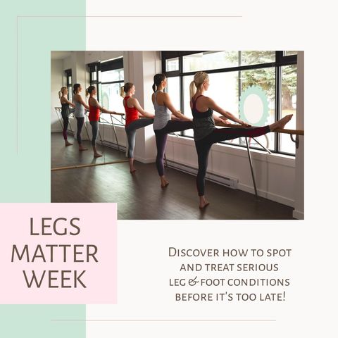 ballet dancers stretching at barre in modern dance studio - Download Free Stock Templates Pikwizard.com