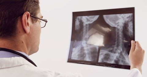Doctor Examining Spine X-Ray Diagnosis Healthcare - Download Free Stock Images Pikwizard.com
