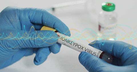 Holding gloved hand with blood tube labeled MONKEYPOX VIRUS in clinical laboratory testing