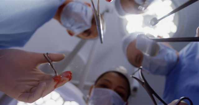 Surgeons focused on a patient during a surgical procedure in an operating room, displaying teamwork and precision. Ideal for use in healthcare publications, medical websites, and articles on surgical procedures and hospital environments.