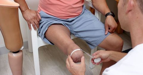 Therapeutic measurement for prosthetic fitment in rehabilitation clinic