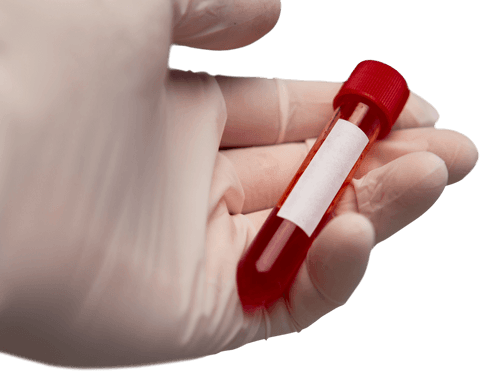 transparent blood sample test tube in doctor's hand - Download Free Stock Videos Pikwizard.com