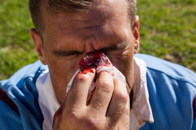 Rugby player holding tissue to bleeding nose on playing field. Useful for topics related to sports injuries, first aid, emergency response, and athletic accidents. Can be used in articles, blogs, and educational materials about sports safety and injury prevention.