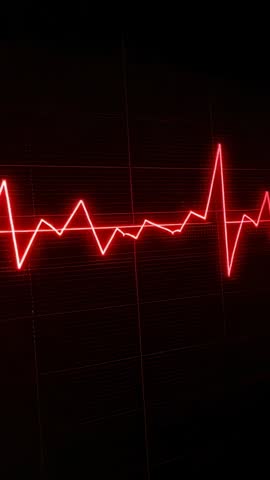 Animating Vertical Red ECG Waveform Shifting Left After Heartbeat Spike
