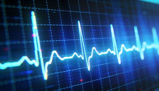 Pulsing neon blue ecg waveform tracing across medical monitor with qrs spikes heartbeat rhythm glow
