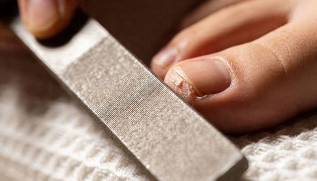 Macro nail filing closeup showing hangnail and cuticle care on fingertip