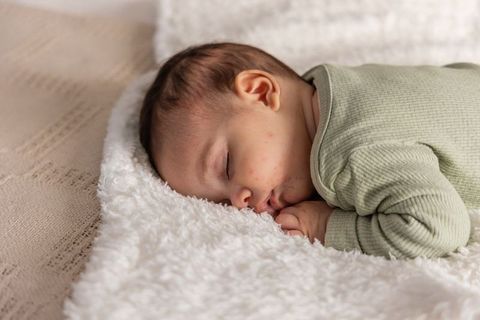 Sleeping newborn with baby acne on plush blanket close-up cozy nursery skincare concept