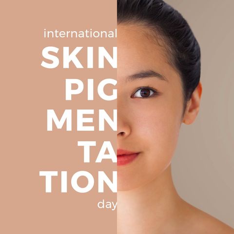celebration of international skin pigmentation day concept - Download Free Stock Templates Pikwizard.com