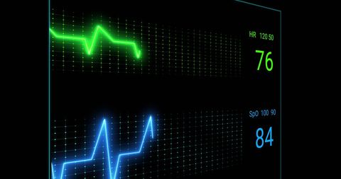 digital cardiograph display with heart rate and spo2 monitors - Download Free Stock Images Pikwizard.com