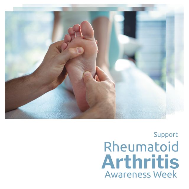 Ideal for illustrating medical support and treatment during Rheumatoid Arthritis Awareness Week. This image can be used in healthcare promotions, arthritis awareness campaigns, and wellness blogs emphasizing the importance of professional care and therapy for managing arthritis.