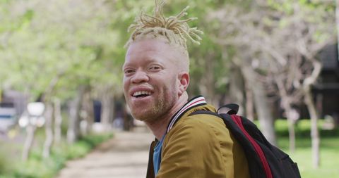 Smiling African American Albino Man with Dreadlocks in Urban Park - Download Free Stock Images Pikwizard.com